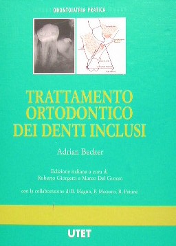 Trattamento ortodontico dei denti inclusi
